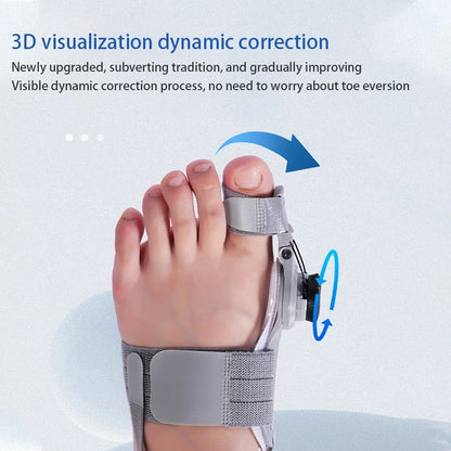 MoonLab R® 🦶 Say Goodbye to Bunion Pain – Naturally and Without Surgery